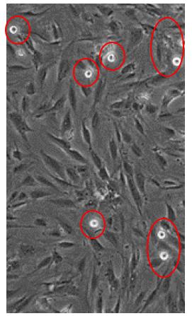 13. Count the cancer cells adherent to HUMVEC under the inverted microscope or take photos (at least 5 fields) using Q-capture pro 7.0 and count the adherent cancer cells.