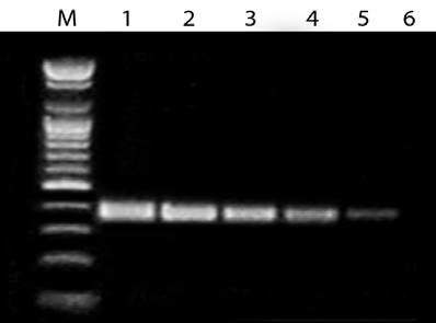 AccuPower Pfu PCR PreMix Experimental Data Figure 1. Template range & sensitivity of AccuPower Pfu PCR PreMix for human DNA template.
