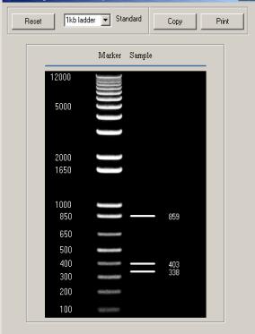 PolyAcrylamide Gel Electrophoresis (PAGE) Can resolve DNA ~30 base to