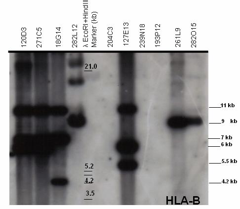 Results 74 Figure 5.2.1.1.12: Autoradiograph after Southern blot hybridization of HLA-B probe with BAC-clone fragments (CHORI-259, Callithrix jacchus).