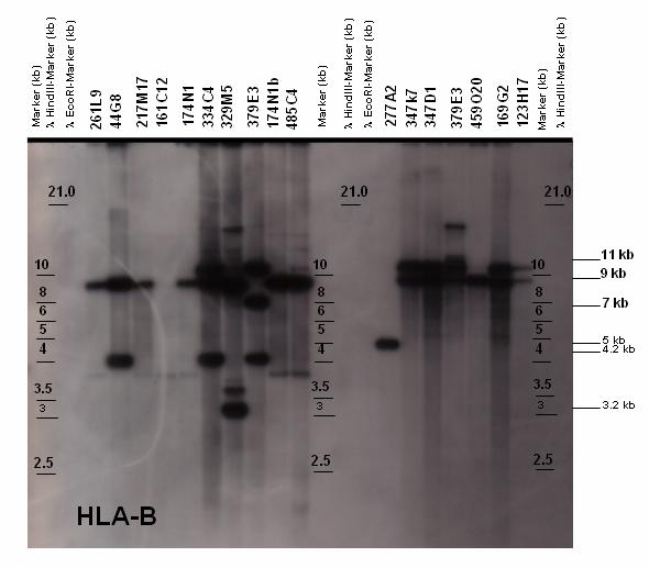 Results 75 Figure 5.2.1.1.14: Autoradiograph after Southern blot hybridization of HLA-B probe with BAC-clone fragments (CHORI-259, Callithrix jacchus).