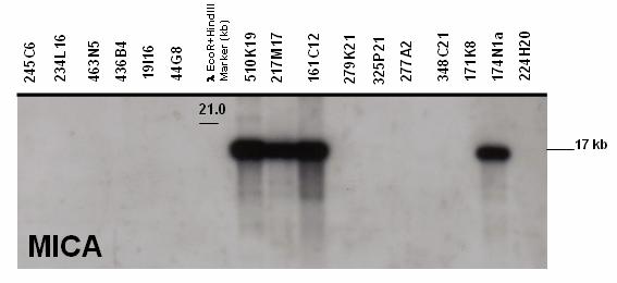 DNA sample Lambda (λ) EcoRI+HindIII used as ladder marker. kb values on the right margin calculated relative to marker DNA fragments which were seen by means of ethidium bromide fluorescence.