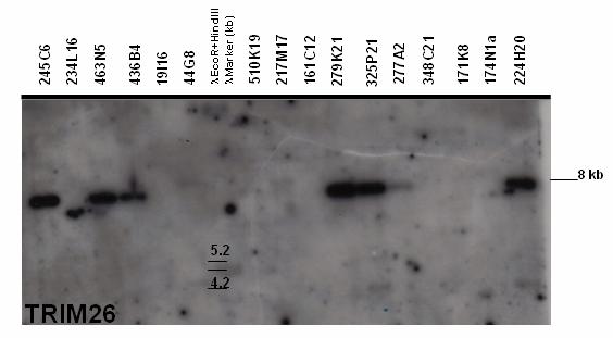 Results 86 Figure 5.2.2.1.2: Autoradiograph after Southern blot hybridization of TRIM26 framework gene probe with BAC-clone fragments (CHORI-259, Callithrix jacchus).