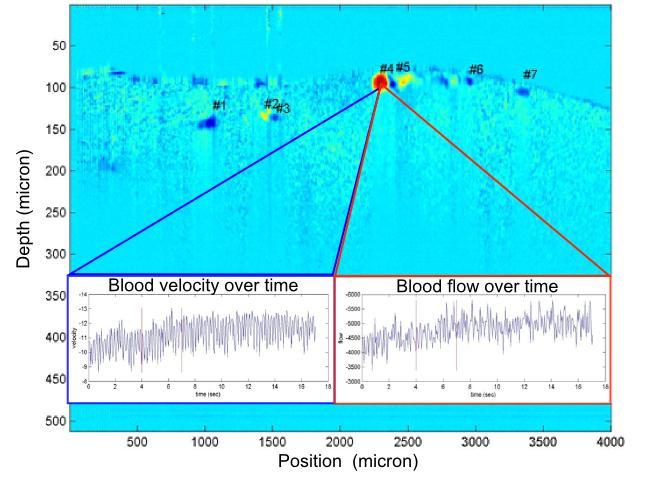 43 Figure 27: Cross section velocity profile with labeled blood vessels. Plots of blood velocity and flow are inserted of a selected blood vessel over time.