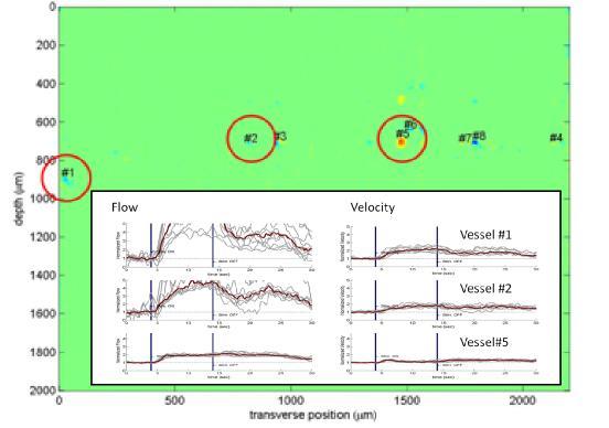 58 Figure 36: Quantitative velocity and flow measurements of selected blood vessels in cross sectional velocity profile image To again quantify what was observed in the Angiograms and cross sectional