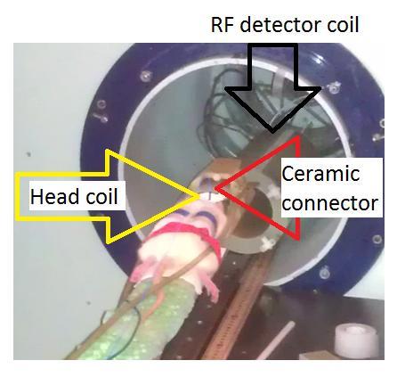 66 Figure 40: Animal on MR scanner gurney with modified head coil and optical fiber connector. The animal and custom components all must fit inside of the RF detector coil in front of the animal.