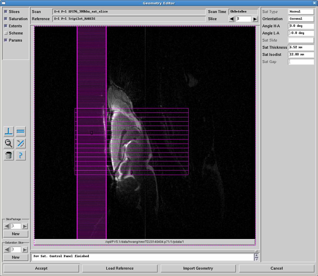 72 Figure 44: Screen shot of MR user interface of functional slice orientation based on anatomic scan.