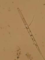 Micrographs of plant-parasitic nematodes found on sugarcane in southwestern