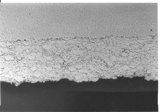 a) b) Fig. 5. Microstructure of a) as-sprayed HVOF Inconel 625 coatings and b) after remelting with 4 kw Nd:YAG laser. Coating thickness is 300 µm.