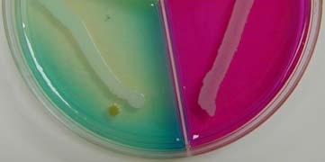 pylori Aerotolerant aerobes Streptococcus Lactobacillus