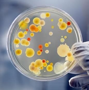 How do we identify the bacteria?