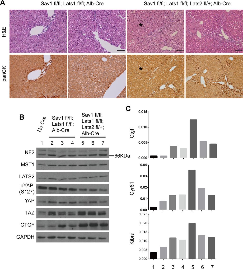 Supplementary Figure S6: Deletion of Lats2 affects more than Lats1 for YAP induced tumorigenesis.