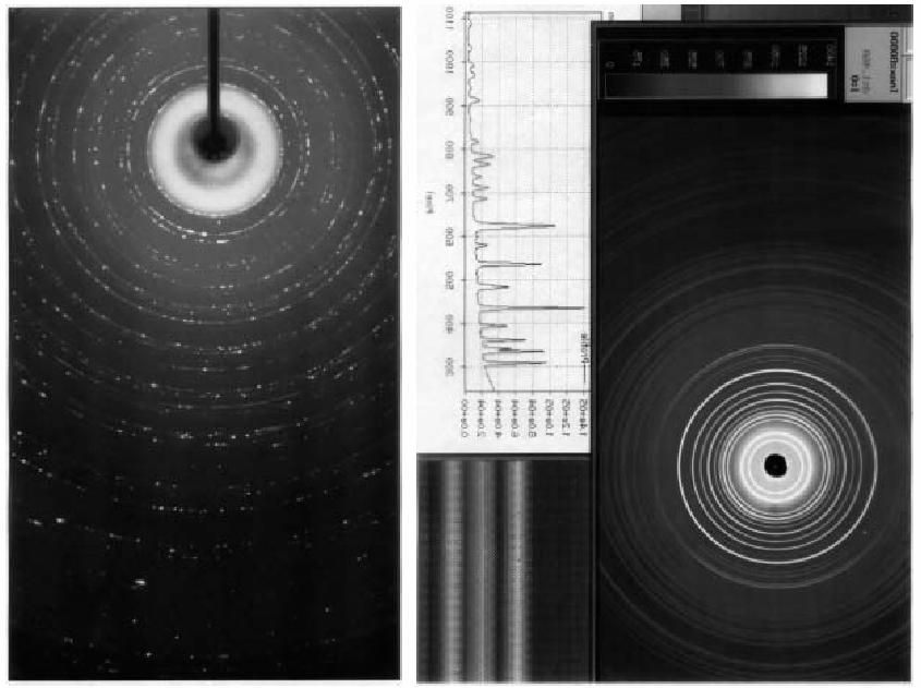 X-Ray Diffraction Image &