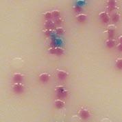 sample. Rambach Agar (Salmonella) 00000RR701 4 x 1 litre* 00000RR703 2 064-PA0082 20 plates 90mm (Colorex ) Microorganism Colony colour Sensitivity Salmonella Red 93,9% (2) E.