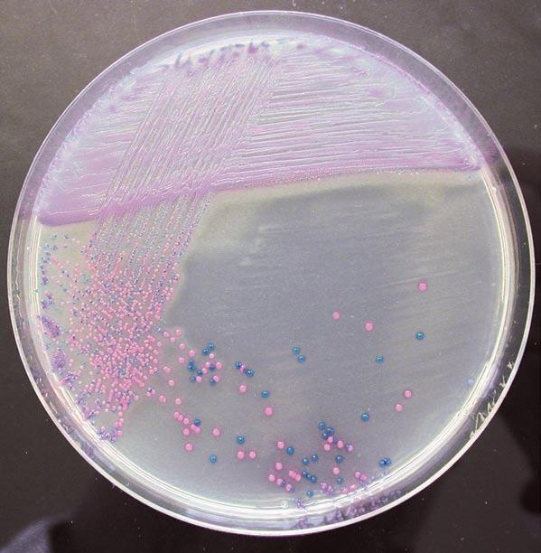 00000CA222 00000CA223 2 064-PA0076 20 plates 90mm (Colorex ) Microorganism Colony colour Sensitivity & Specificity Candida albicans Green > 99% (11) Candida tropicalis Metallic blue > 99% (11)