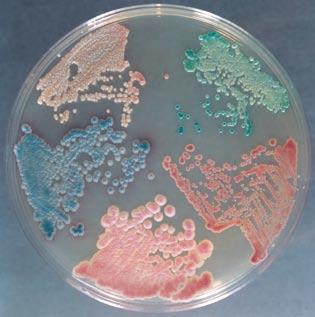 32: 1923-1929 CHROMagar Orientation The major target of this medium is the detection of urinary tract pathogens with E. coli as red colonies, Klebsiella as metallic blue colonies, P.