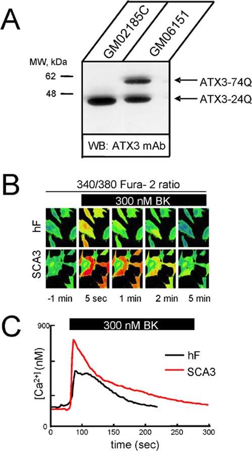 Chen et al. Calcium Signaling in SCA3 J. Neurosci., November 26, 2008 28(48):12713 12724 12719 Figure 4. Ca 2 signals in primary human fibroblasts from SCA3 patient.