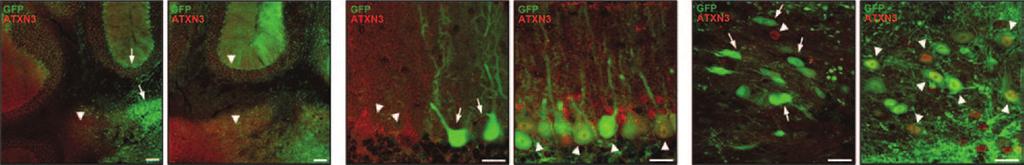 a b c Cerebellum Purkinje cells Deep cerebellar nuclei mirmis mirmis mirmis Figure 4 Cerebellar neurons transduced with the AAV/1--hrGFP virus show depletion of ATXN3 1 weeks after delivery.