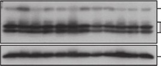 (b) Immunoblotting for NeuN shows similar levels in the cerebella of all infused groups. Three mice (1 3) were used per group. (c) Quantiﬁcation of the immunoblots shown in b.