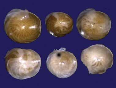 Usefulness Amphistegina makes an ideal bioindicator because: They require similar environmental conditions to zooxanthellate corals, They are an easily identifi able, widely distributed genus that is