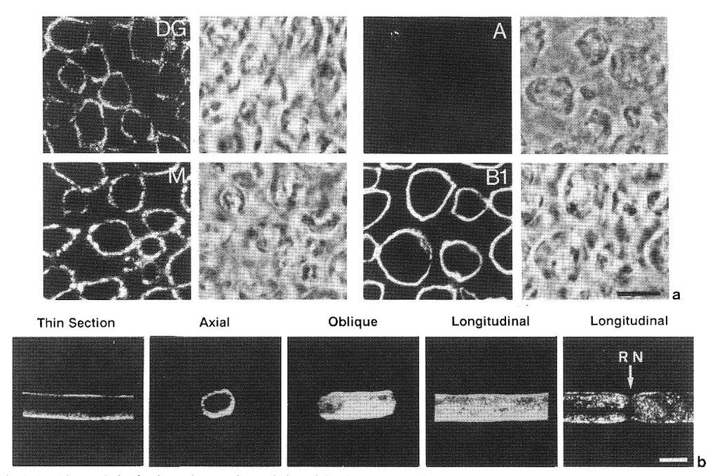 50 H. Yamada et al. /FEBS Letters 352 (1994) 49-53 Fig. 1. (a) clsm analysis of α-dystroglycan and merosin in peripheral nerve. clsm fluorescent and the corresponding phase-contrast images are shown.