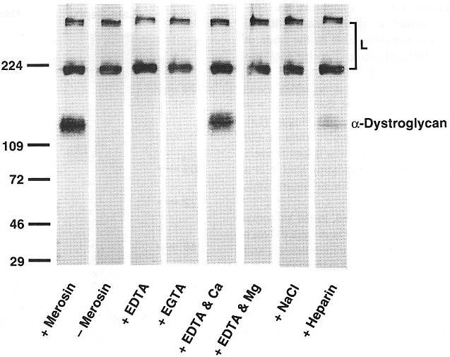 52 H. Yamada et al. /FEBS Letters 352 (1994) 49-53 Fig. 4. Merosin-binding properties of peripheral nerve α-dystroglycan.