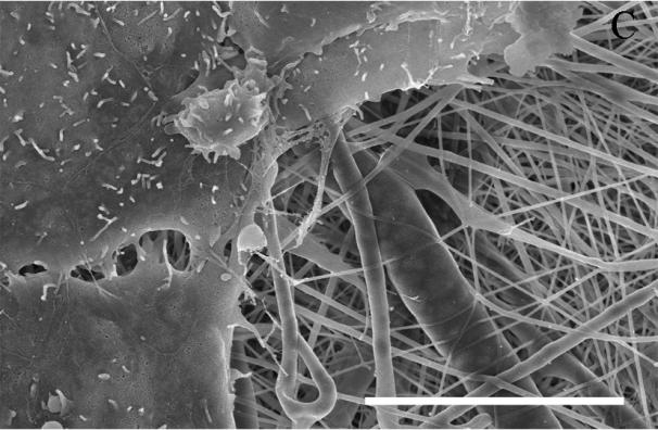 The high viabilities of 3T3 fibroblasts suggested that electrospun SELP-47K nanofibrous scaffolds are highly biocompatible. Figure 3.21.