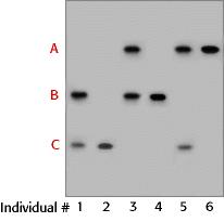 Analysis of a VNTR locus by Southern hybridization most commonly results in a two-band pattern, comprised of a band inherited from