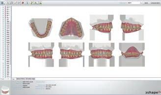 Improve orthodontic treatment with ISO accuracy-documented scanners Connect directly to TRIOS