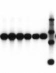 Typical results with the kit Experiment 1. A B C -actin Figure 30. Integrity of isolated mrna, demonstrated by northern blotting.