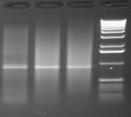 Appendix B: Analyzing First-Strand cdna continued 15 18 21 M kb 5 4 3 2 1.6 1 0.5 Figure 2. Analysis of first-strand cdna synthesized for SMART mrna amplification. 1 µl (1.