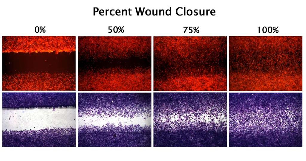 Calculation of Results Percent Closure: 1. Determine the surface area of the defined wound area (see Figure 1). Total Surface Area = 0.9mm x length 2.