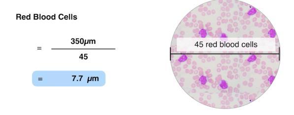 Because these cells contain no nucleus, they are quite small in size in comparison to white blood cells with a theoretical diameter of 7um (micrometers).