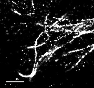Localization Microscopy Sample Prep Background looks identical to real signal DLM image of microtubules Are these small dots from the structure of interest or from background?