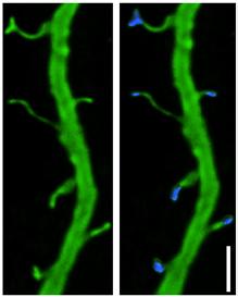 (a) App swe/lnd -expressing CA1 neurons filled with biocytin and revealed using streptavidin-alexa Fluor 555 (green channel).