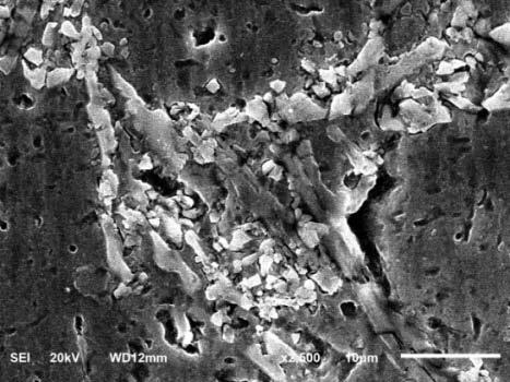The SiCp particles were homogenously dispersed and uniform distribution of reinforcement particles in the matrix phase is observed from these SEM micrographs.
