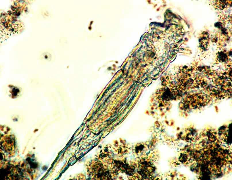 Rotifer (Sign of a
