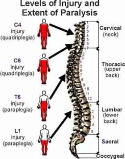 Neurorepair in Spinal Cord Injury K.O.