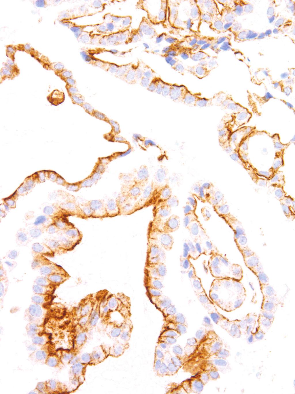 GeneAb TM BRAF V600E Clone: IHC600 Source: Mouse Monoclonal Positive Control: Colorectal Adenocarcinoma 1. Intended Use This antibody is intended for in vitro diagnostic (IVD) use.