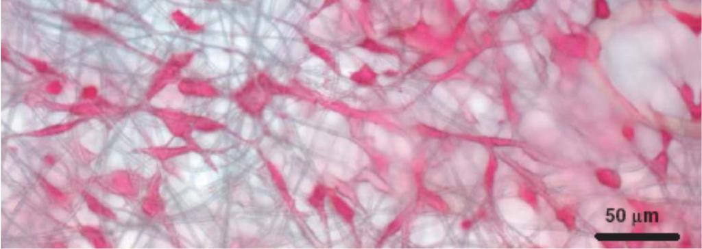 Murine calvaria cells (MC3T3-E1) seeded onto an electrospun PLLA + collagen SUNY Stony Brook Liwei Lin,