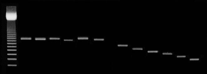 HERPES MULTIPLEX PCR Results of PCR amplification with external and internal primers HSV
