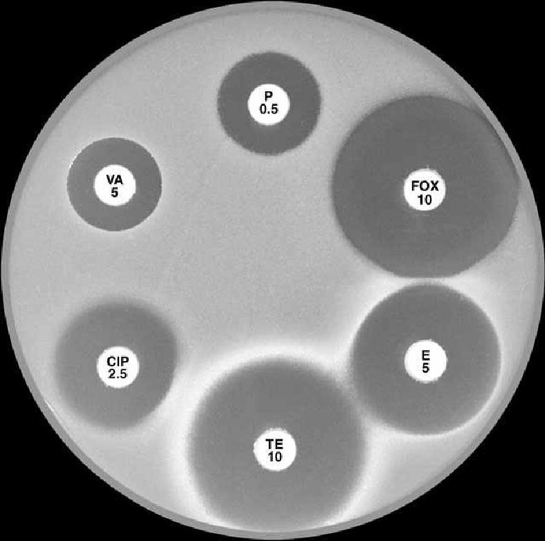 Antibiotic Disk Zone of Inhibition Figure 21: