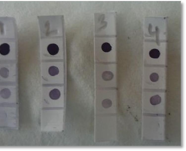 3.7.2 Results of immunodot blot assay using specimens prepared by RBC lysis with no CO 2 The specimen prepared by RBC lysis with no CO 2 was tested by immunodot blot assay with a concentration of MP
