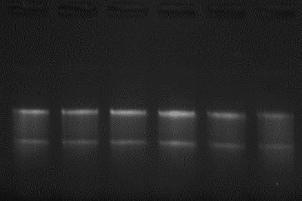 performed using an identical E. coli culture by 5 min Cell/Virus RNA Extraction Kit. Total 1.5 ml of saturated E. coli culture was used for each preparation.