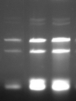 Six blood samples were used for RNA extraction by Cell/Virus RNA Extraction Kit within an hour of collection. Ten ul of final Elution Buffer was analyzed on 1 % agarose gel.