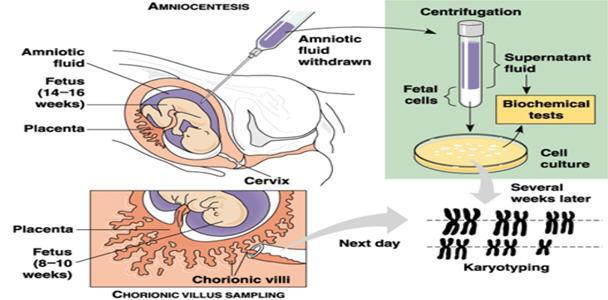Cells are removed from the membrane called the chorion which surrounds the amniotic sac. The chorion membrane contains fetal cells which have genetic information inside them.