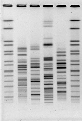 Pulsed Field Gel Electrophoresis (PFGE) DNA is trapped in agarose plugs and digested with restriction