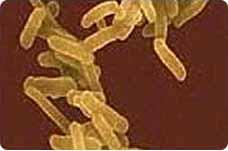 Shigella species Family: Enterobacteriaceae Causes bacillary dysentery 4 Serogroups: S.