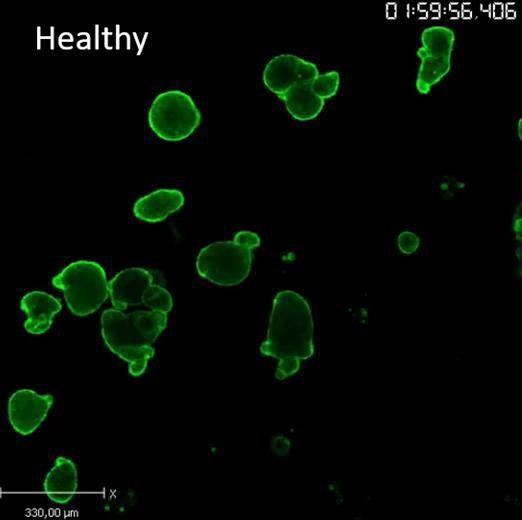 Organoids For Cystic Fibrosis Screening A CF assay on