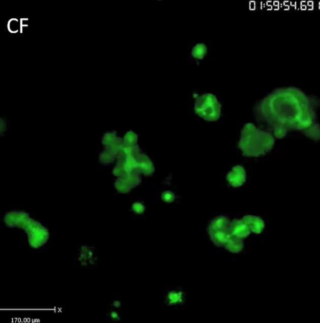 activation: Swelling of Organoids CF mutated CFTR
